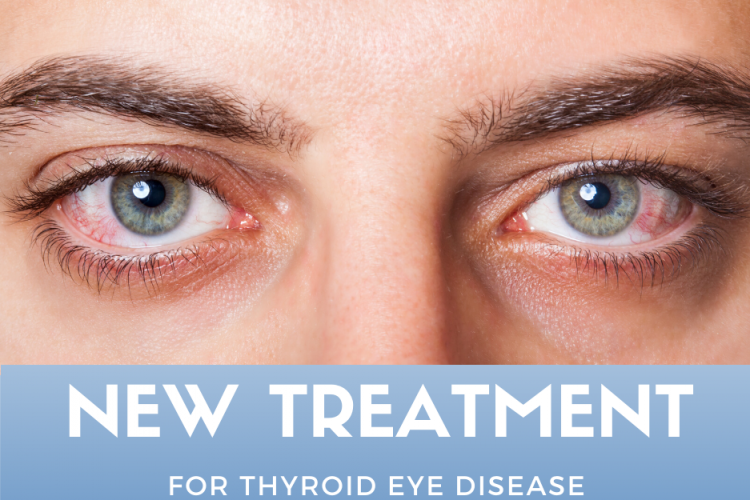 სტეროიდებთან ერთად სტატინების გამოყენება აუმჯობესებს თვალის თირეოიდული დაავადების გამოსავალს
